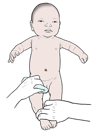 Isang kamay hawak ang bagong silang na lalaking sanggol sa pagpalit ng diaper pad at isa pang kamay na nililinis ang ari ng sanggol.