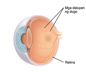 Cross section ng three-quarter view ng mata na ipinakikita ang normal na mga daluyan ng dugo sa retina.